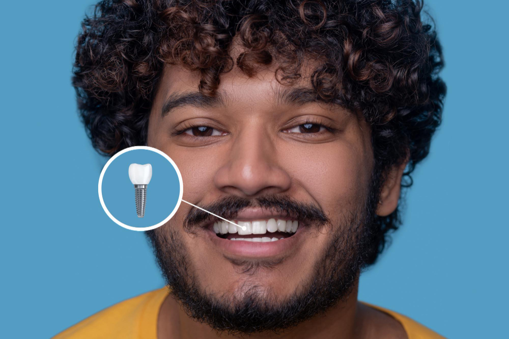 Implant Restoration Harbor City, CA