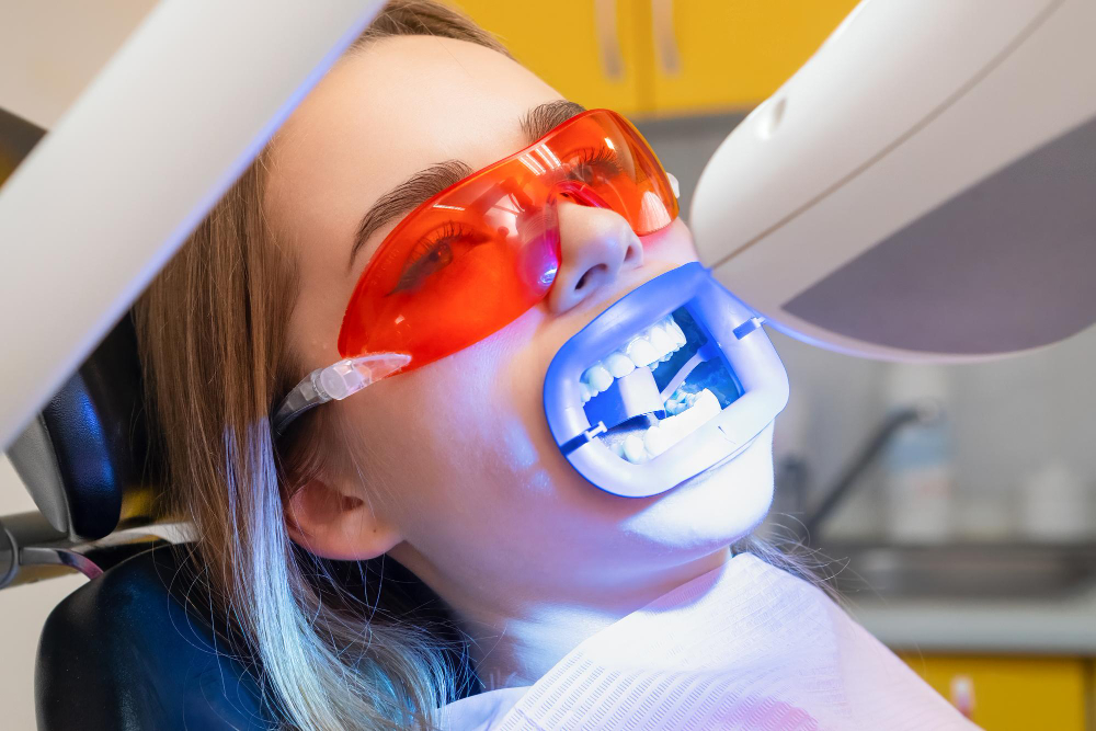 Teeth Whitening Harbor City, CA